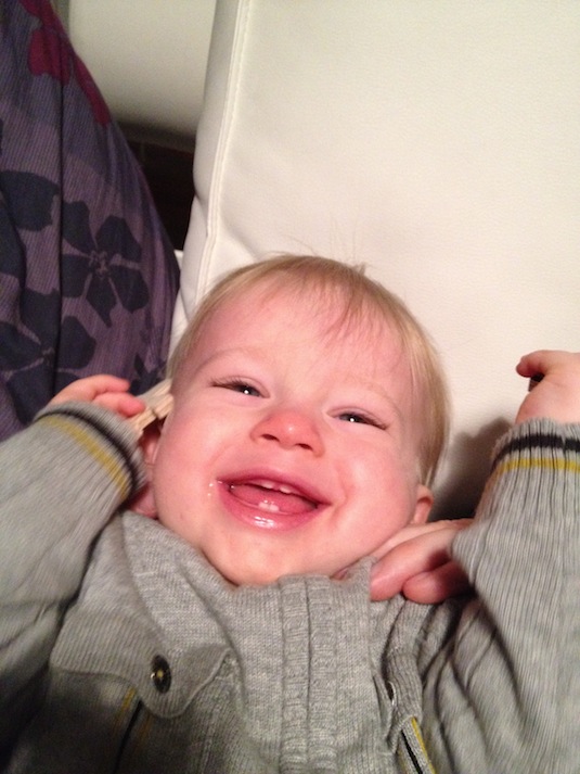 charlie_4_dents